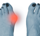 הלוקס ולגוס - תמונת אווירה